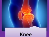 A graduate’s guide: The knee